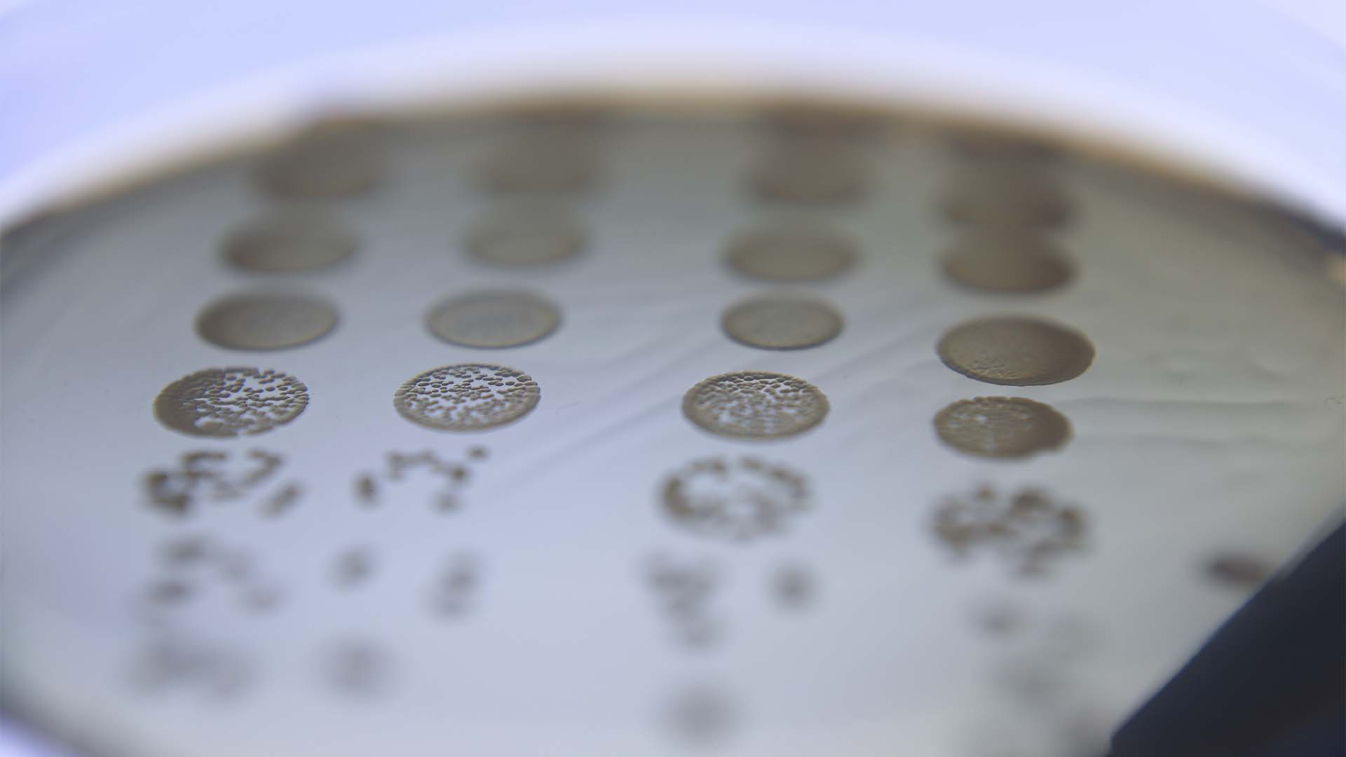 Sem antibiótico. Vírus são a aposta da PhageLab contra salmonela